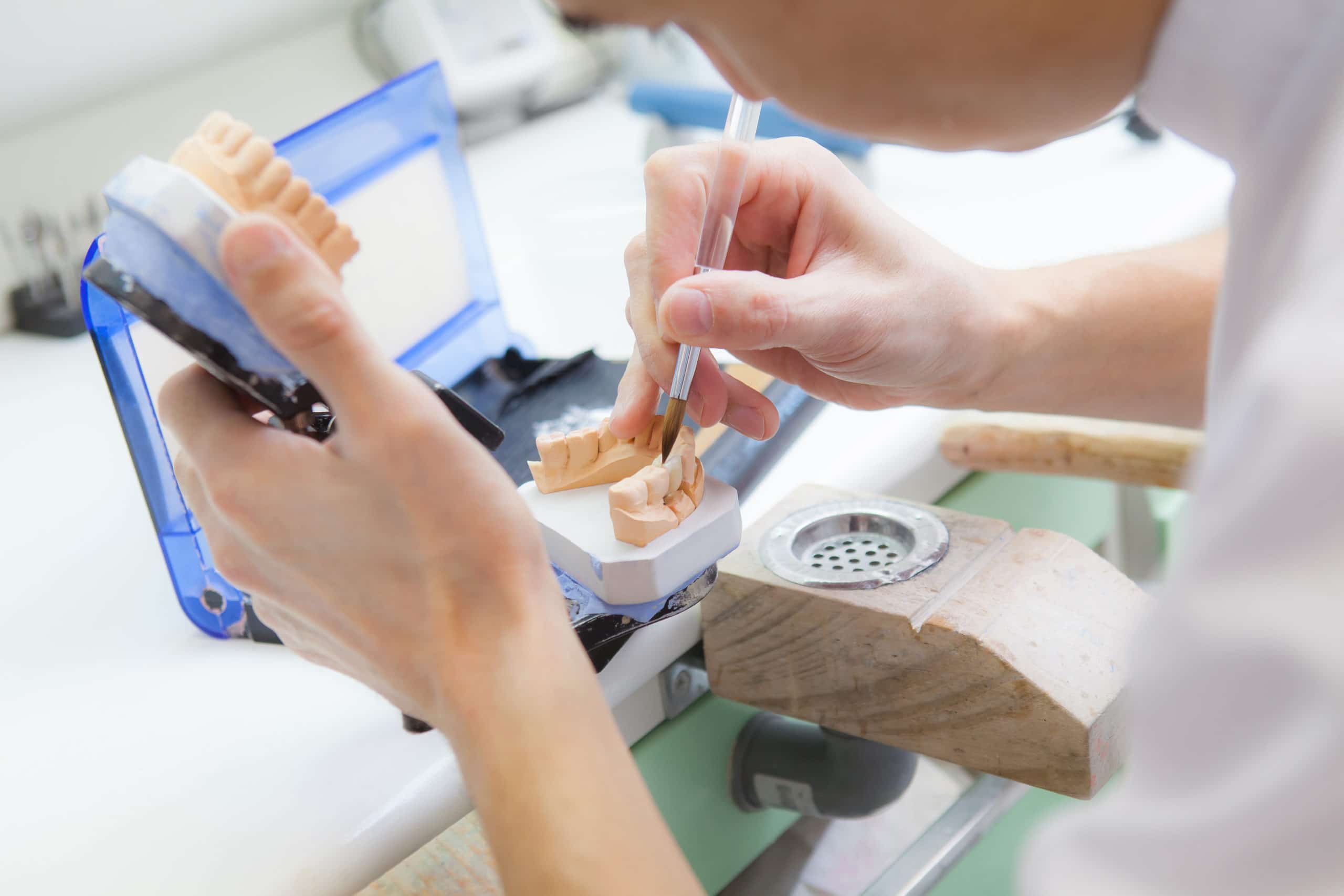 preparing designs for dental veneers for patient
